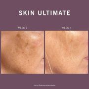 Skin Ultimate