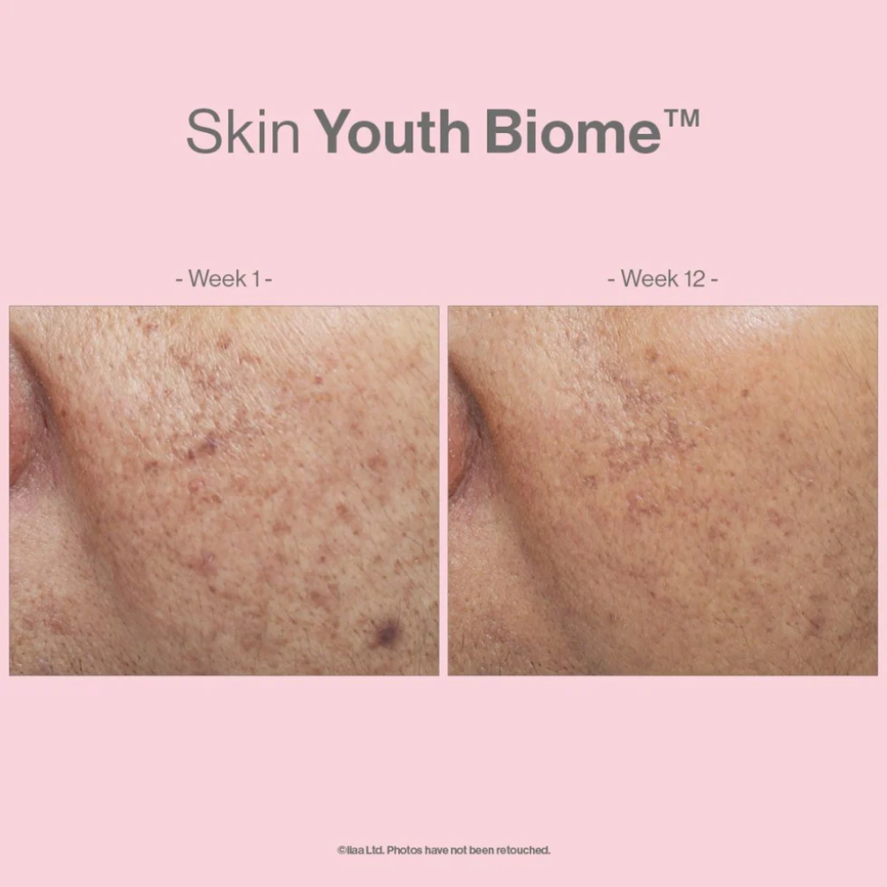 Advanced Nutriton Programme, Skin Youth Biome, biotic, skin health,
