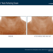 SkinBetter Science Techno Perfecting Neck Cream results