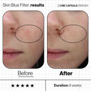 Blue skin filter Before and after image 1