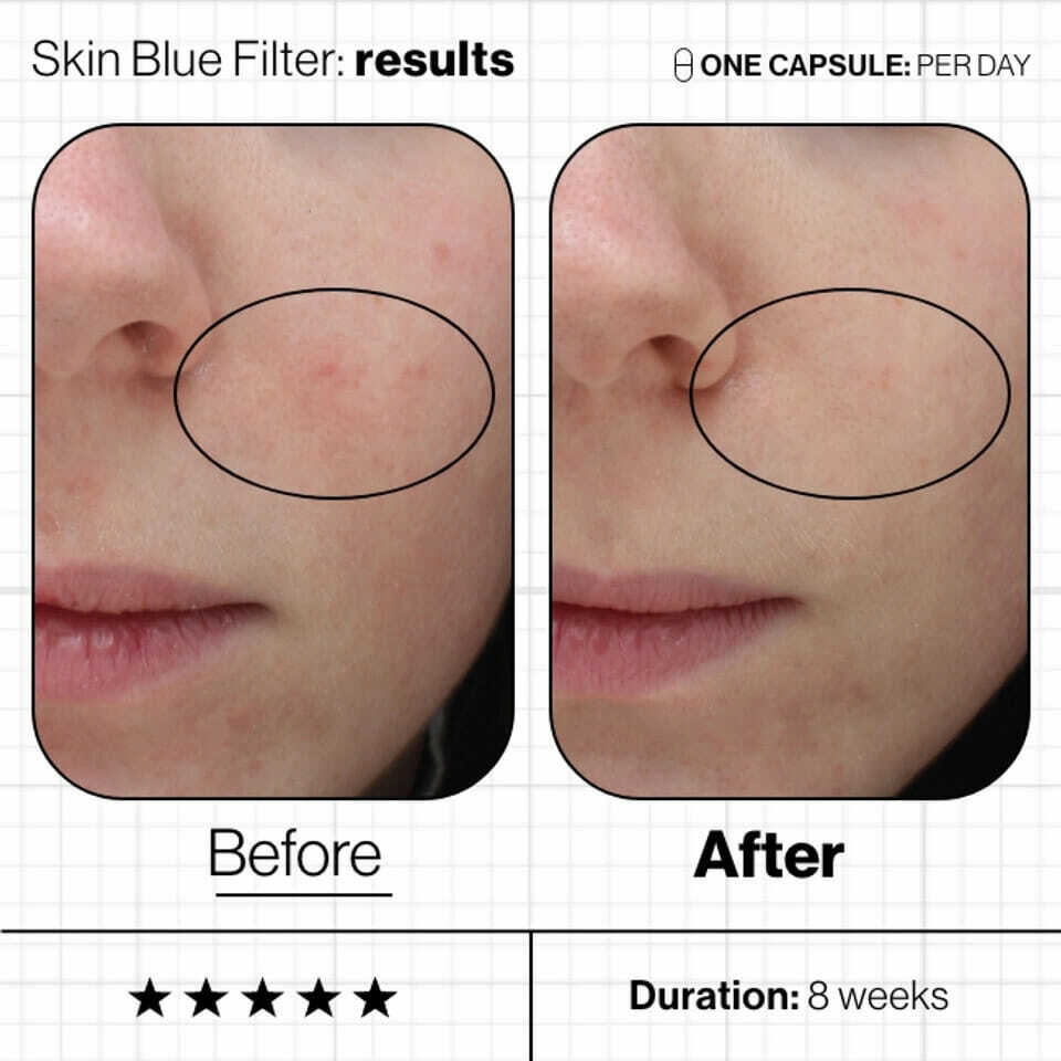 Skin Blue Filter