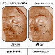 Blue Skin Filter before and after image 2