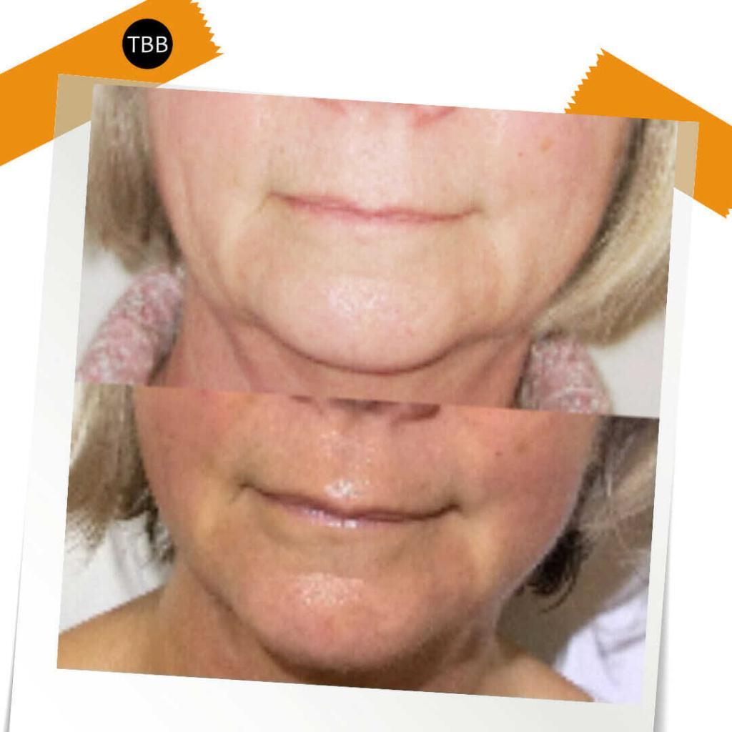 90 minute bespoke treatment