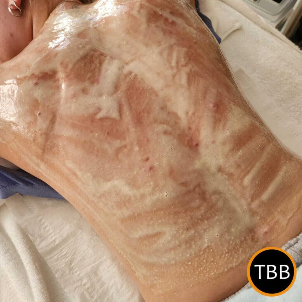 DMK Enzyme Body Treatment