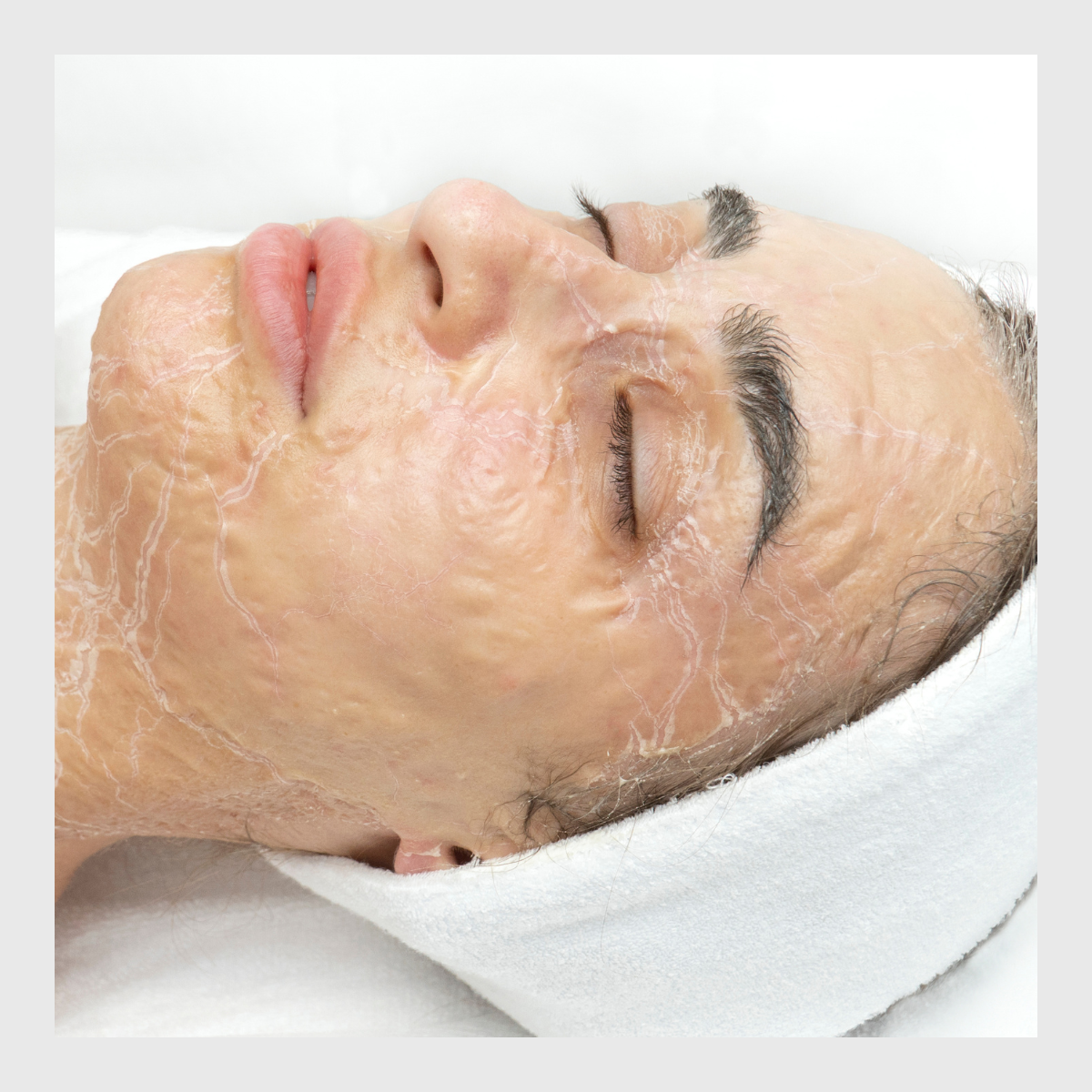 DMK Skin Revision, Skin treatments, Enzyme therapy, advanced facials & Vascular Stimulation