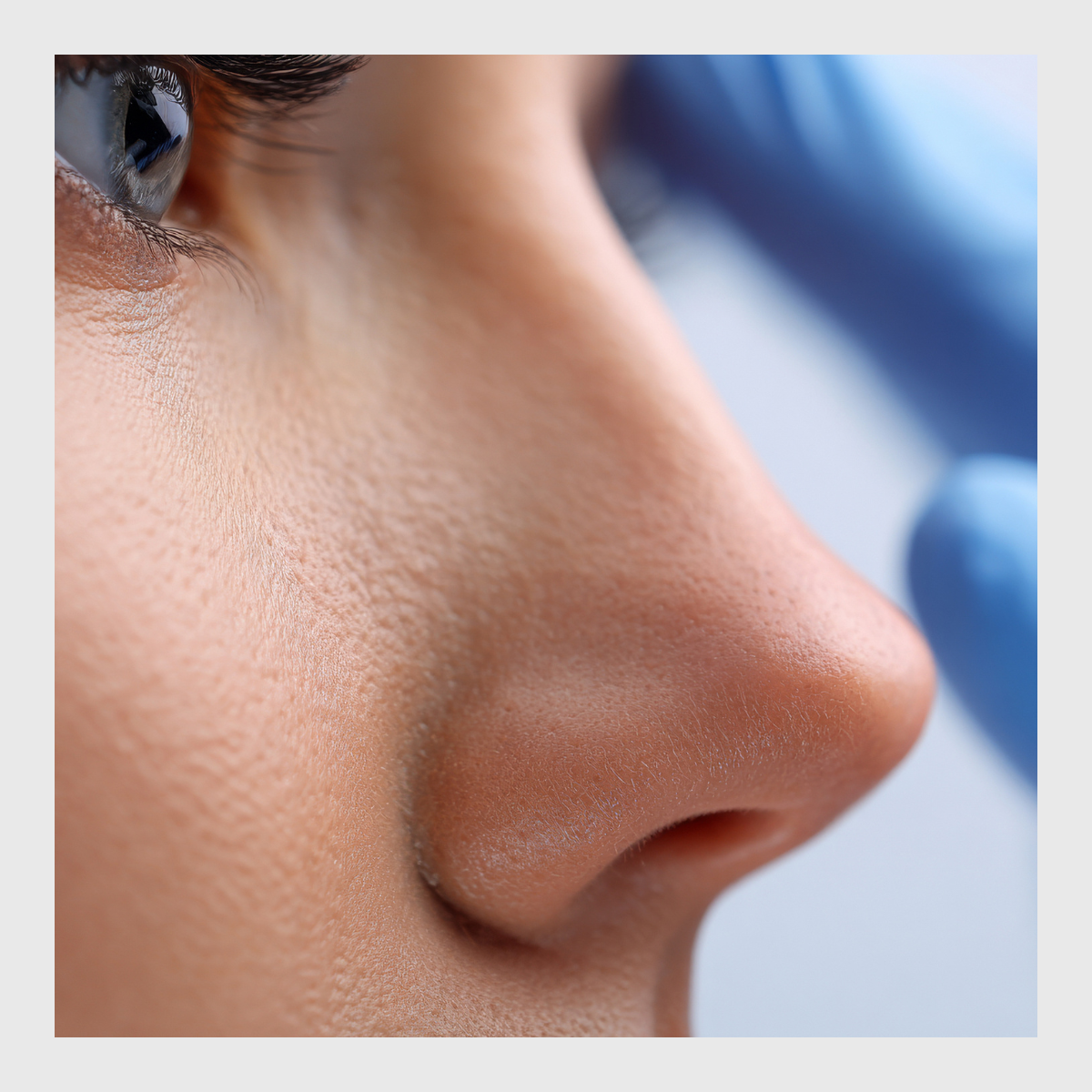 Consultations, skin consultation, Skin analysis Southampton, Skin consultation in Southampton, Skin consultation in Hedge End, Skin Analysis in Hedge End