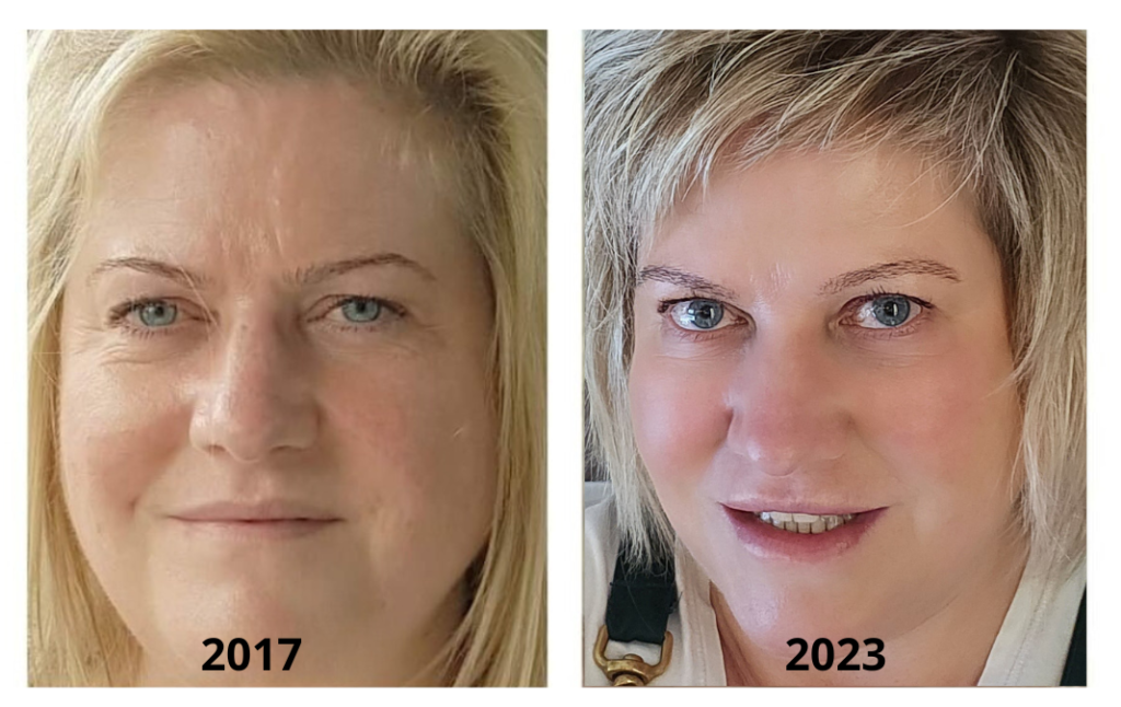 Bev's skin