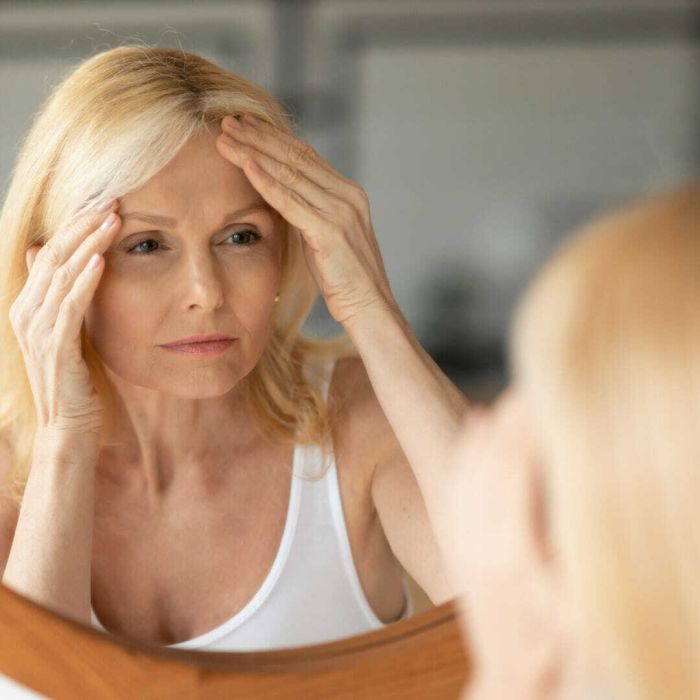 What is perfect skin?