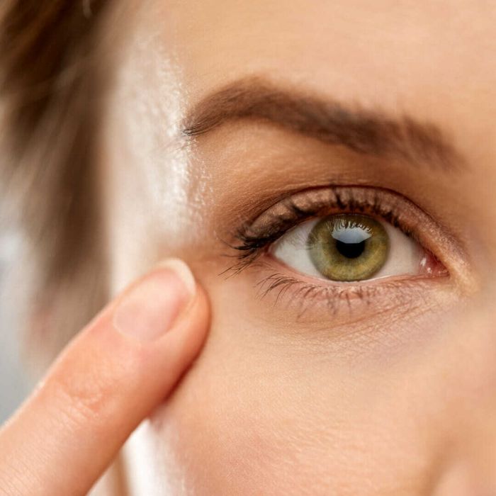 Eye Treatments - How to achieve youthful eyes