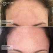 Sente Before and after (2)