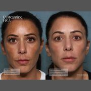 Sente before and after (3)