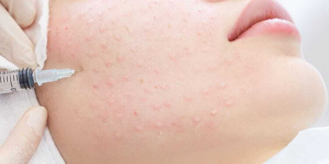 Polynucleotides, skin repair, skin rejuvenation, skin health, skin hydration