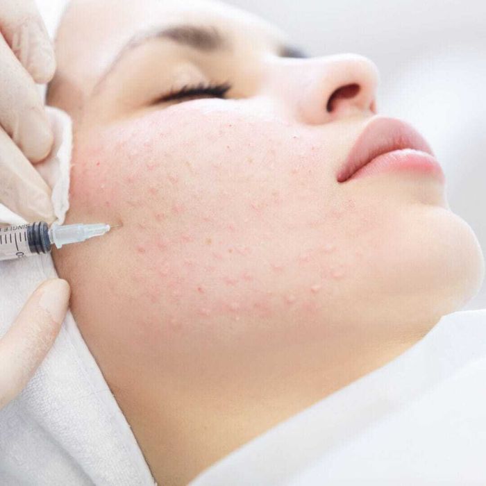 Polynucleotides, skin repair, skin rejuvenation, skin health, skin hydration