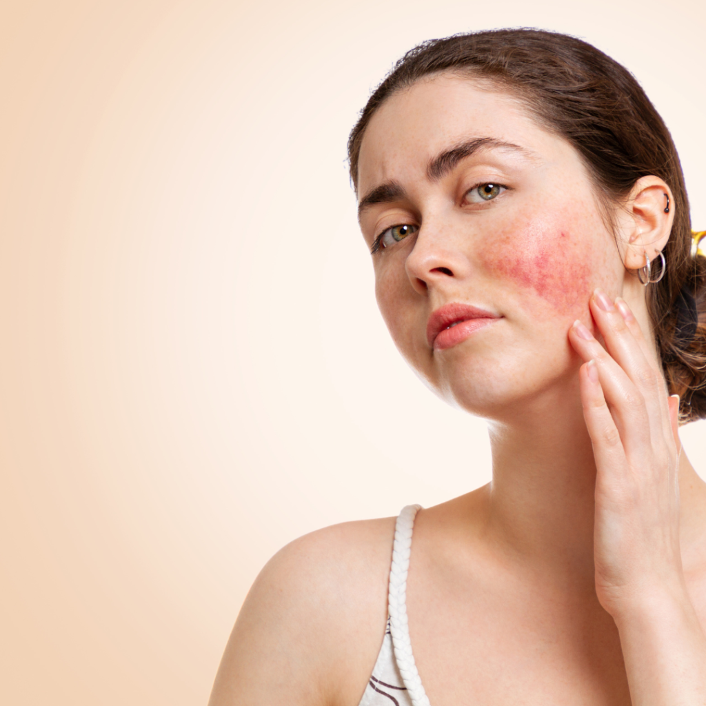 Blemishes