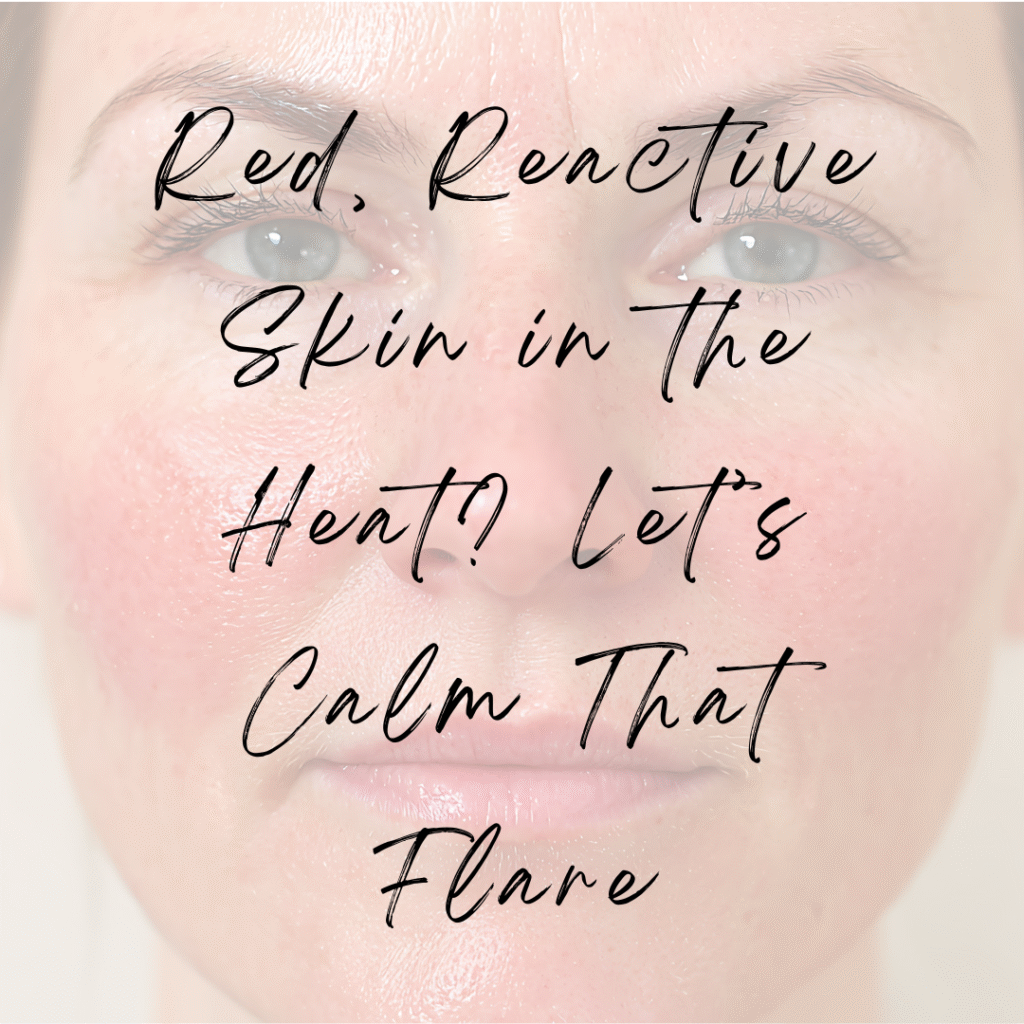 Rosacea, red skin, skin, flushing, redness, summer heat, rosacea flare
