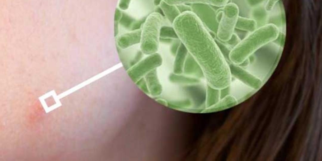 Skincare that contains biotics, prebiotics, probiotics, postbiotics, skin, skin health, healthy skin, skincare, microbiome, bacteria, biotics,