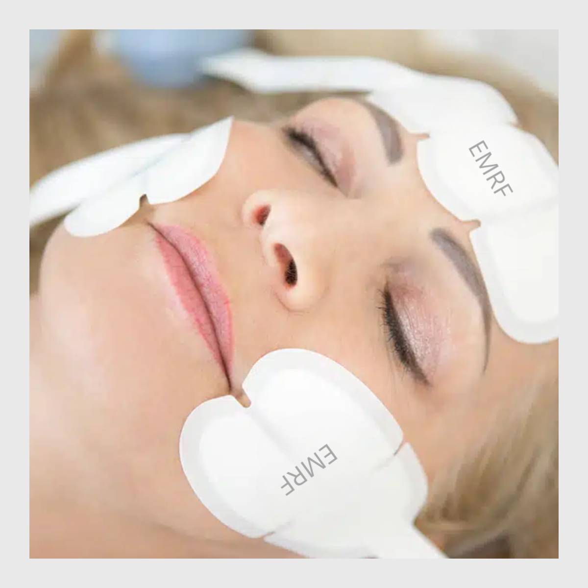 EMRF Facial, radio frequency, muscle lifting, anti-ageing facial, electrical facial, muscle lifting, non surgical face lift, skin tightening