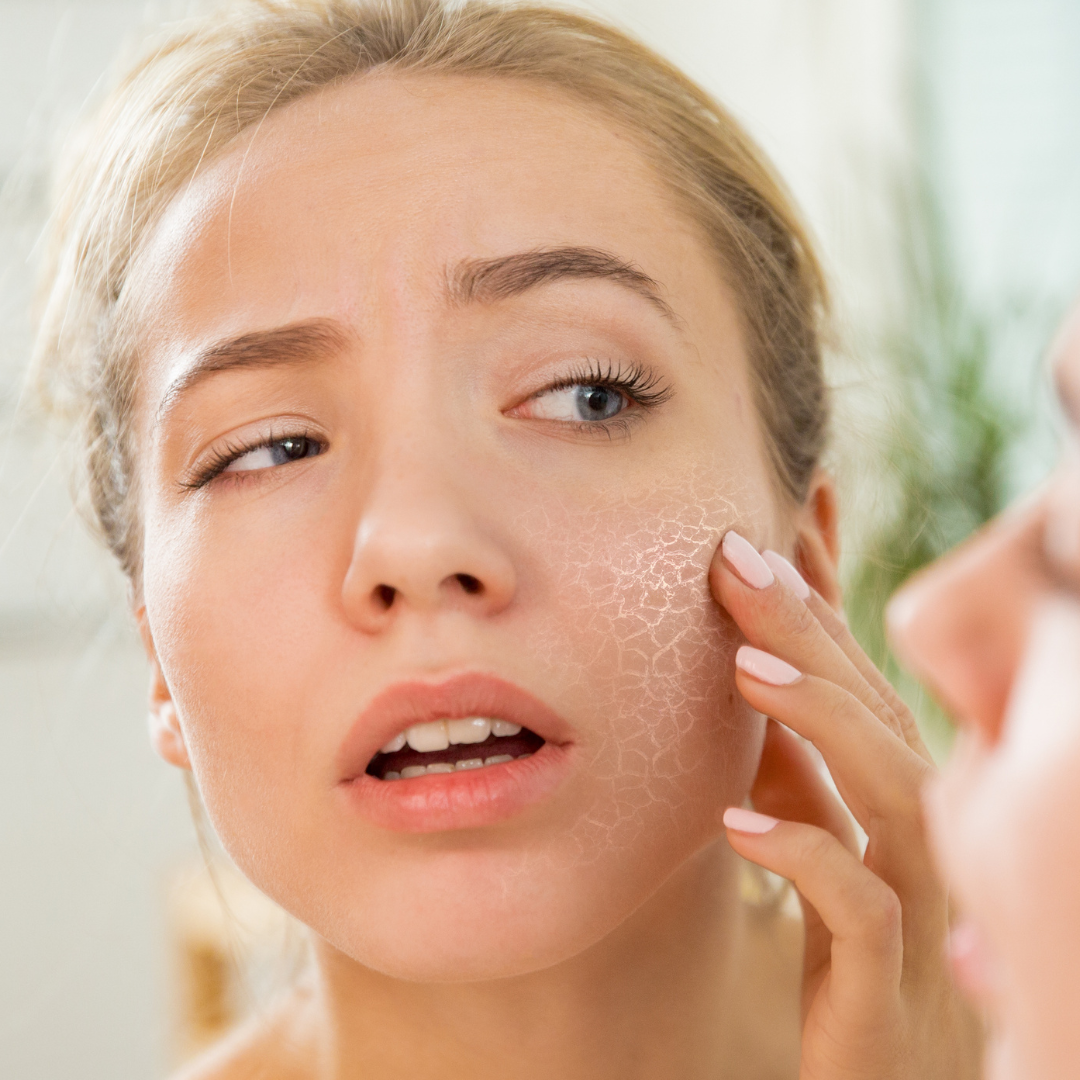 Skin Stress, cortisol, stressed skin, reactive skin, skin, skin health, barrier repair