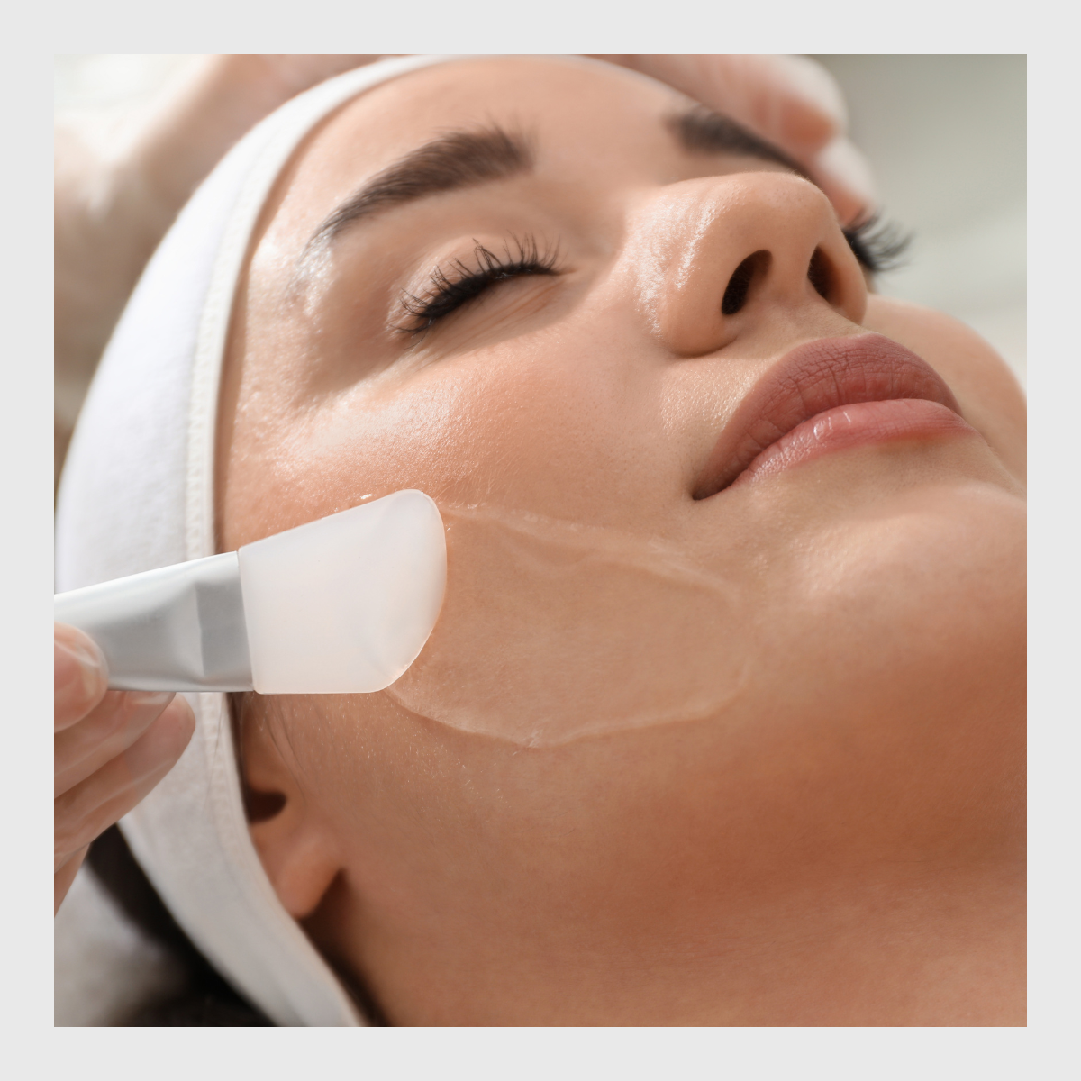 Chemical Peels, Toskani Duosomals, acne skin, pigmentation, rejuvenation, skin, skin treatment, exfoliation, skin peel