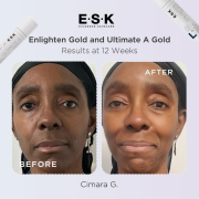 Before and after of a woman with black skin